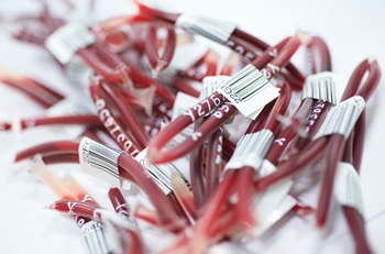 Blood samples